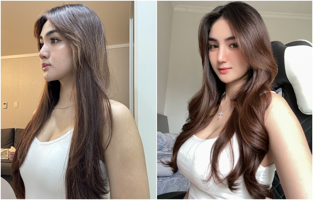 CHI PHÍ NÂNG MŨI TẠI HÀN QUỐC ĐƯỢC TƯ VẤN CHI TIẾT